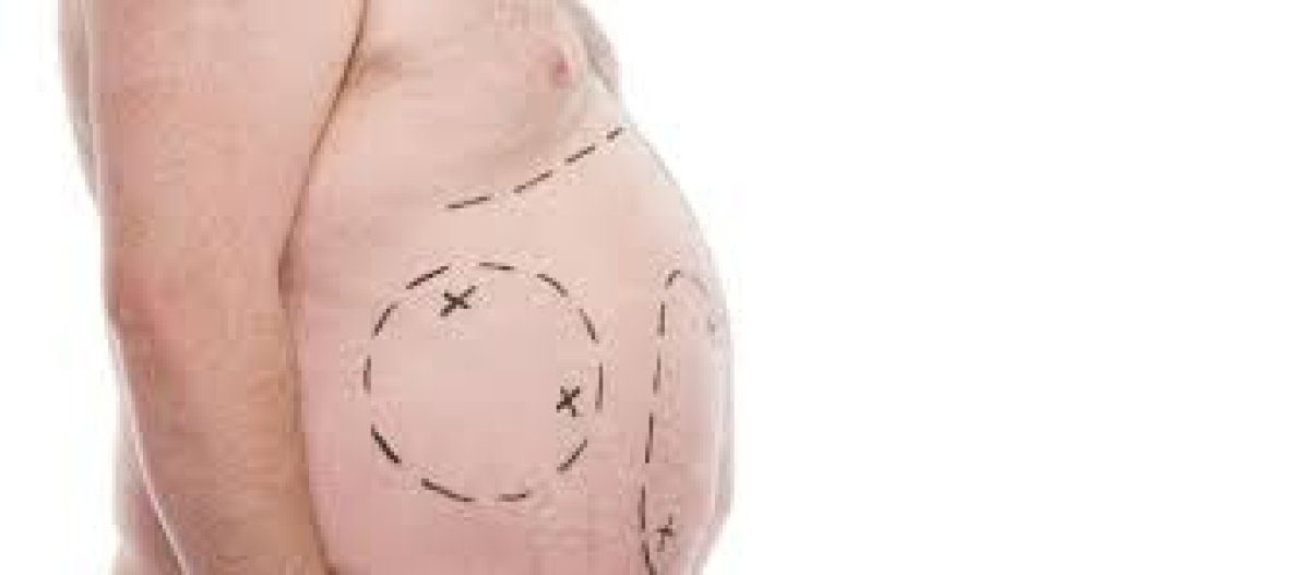 Fazla Kilo Vasküler Demansa Yol Açıyor: Kapsamlı Araştırma